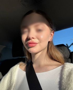 Escort Dnipro : Ksyusha - photo 5